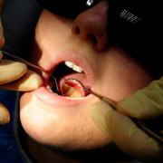 Lib Dems called for an emergency dental registration scheme for children (Rui Vieira/PA)